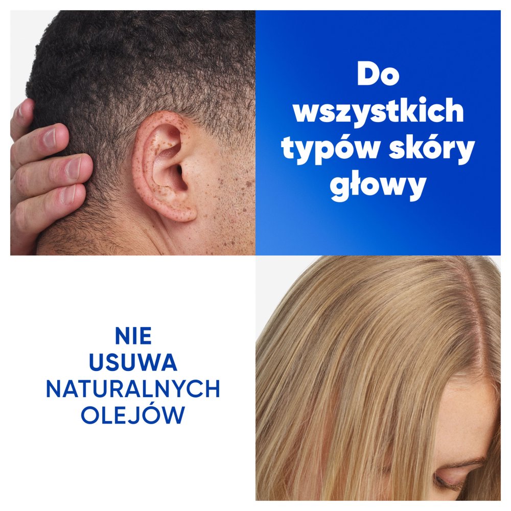 Head & Shoulders Citrus Fresh Codzienny Szampon Przeciwłupieżowy 250 ml do Włosów Tłustych (4)